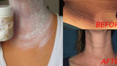 photo of black neck underarms and inner thighs remedy
